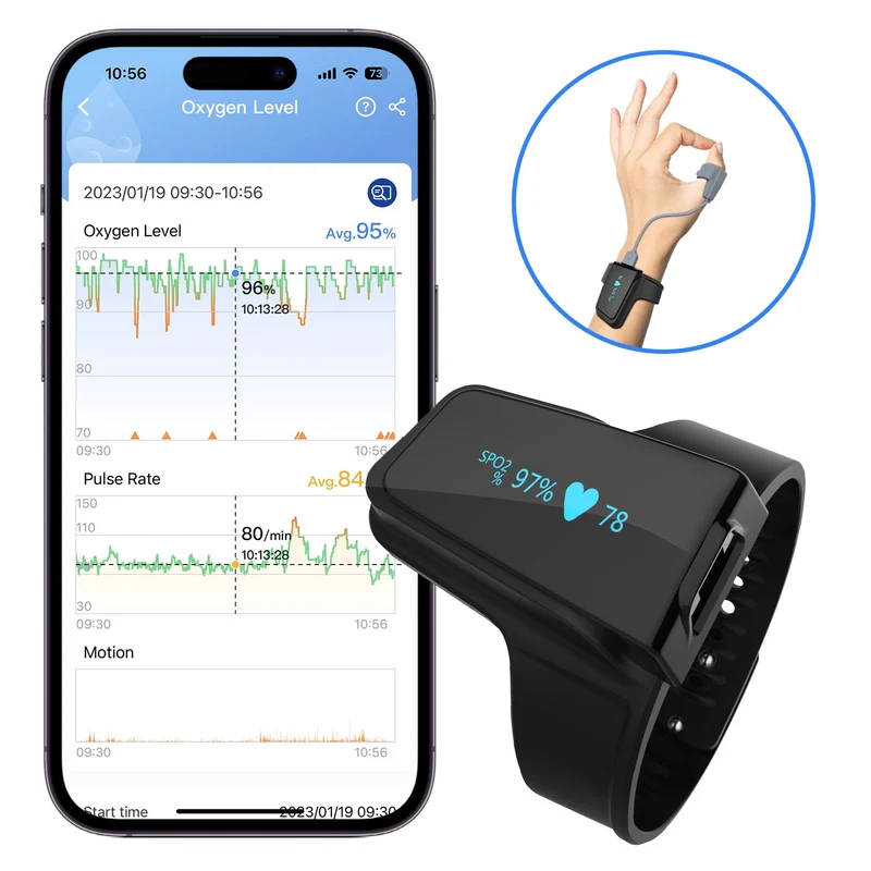 Checkme™ O2 Handgelenk-Sauerstoffmonitor