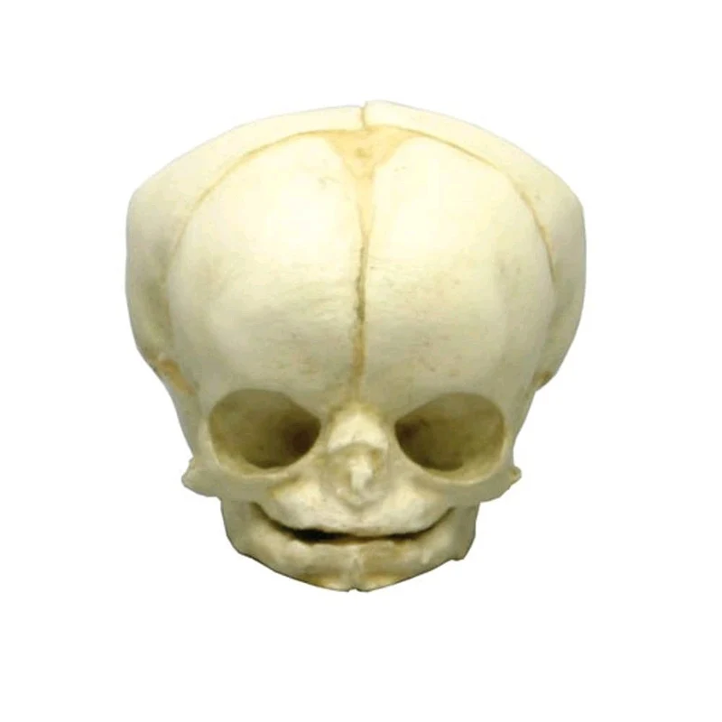 Erler Zimmer Fetusschädel Anatomie Modell, versch. Entwicklungs-Wochen