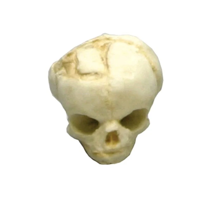 Erler Zimmer Fetusschädel Anatomie Modell, versch. Entwicklungs-Wochen