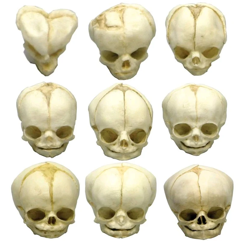 Erler Zimmer Fetusschädel Anatomie Modell, versch. Entwicklungs-Wochen