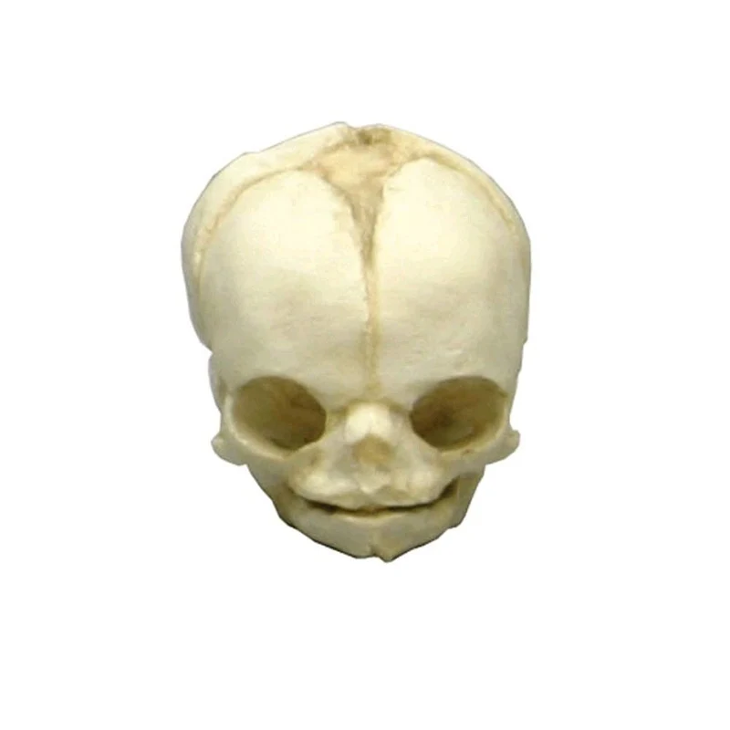 Erler Zimmer Fetusschädel Anatomie Modell, versch. Entwicklungs-Wochen