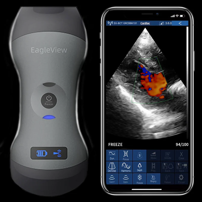 EagleView™ Drahtloser Sonden-Ultraschallscanner