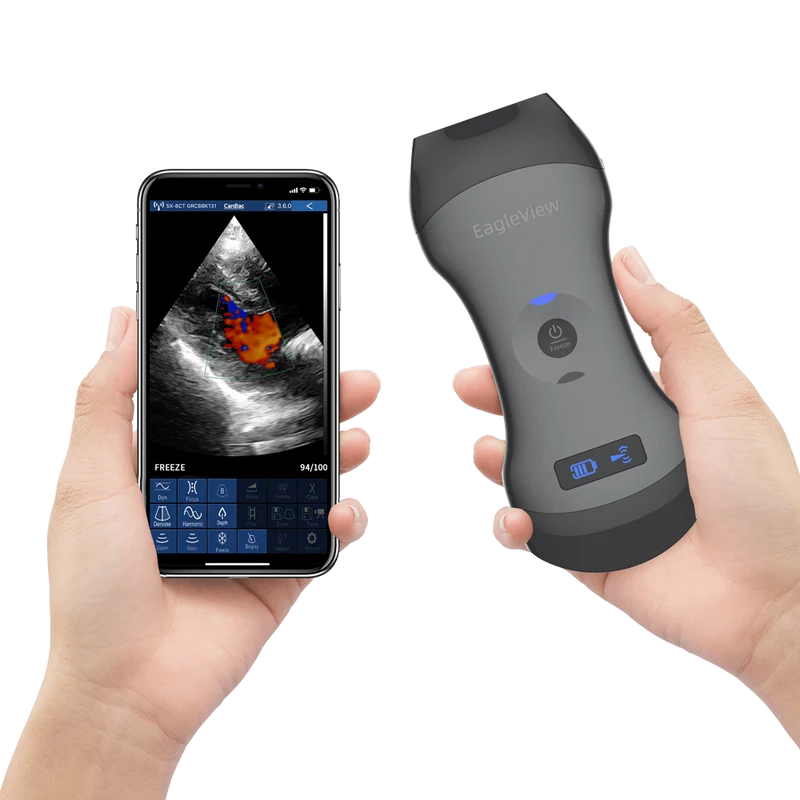 EagleView™ Drahtloser Sonden-Ultraschallscanner