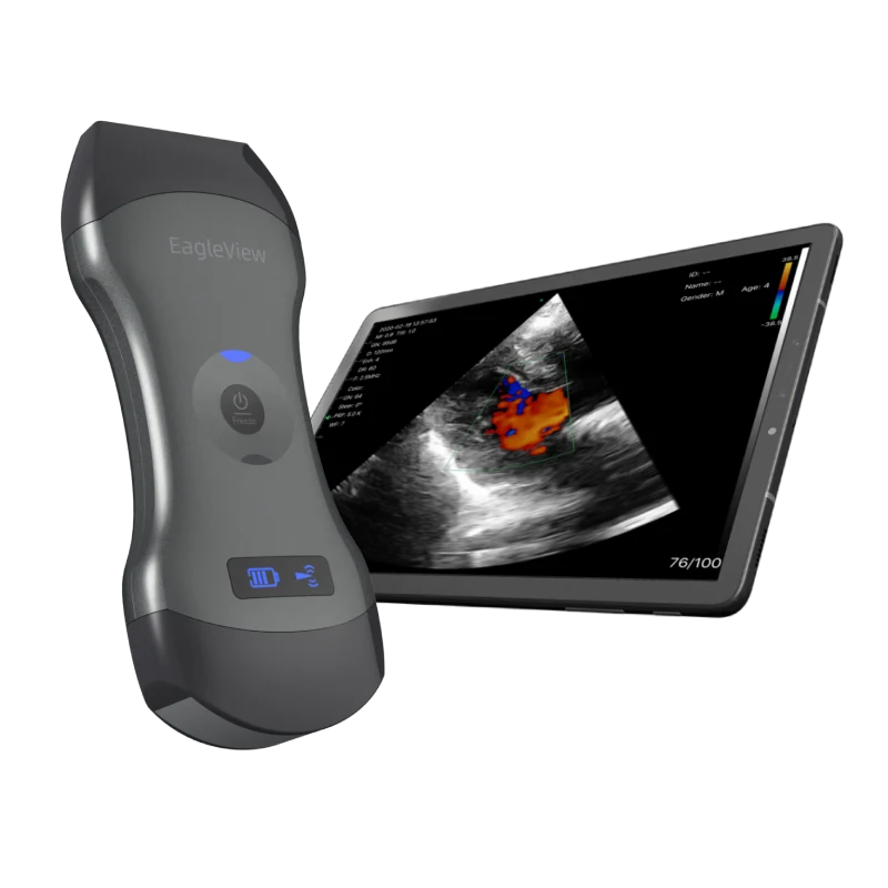 EagleView™ Drahtloser Sonden-Ultraschallscanner