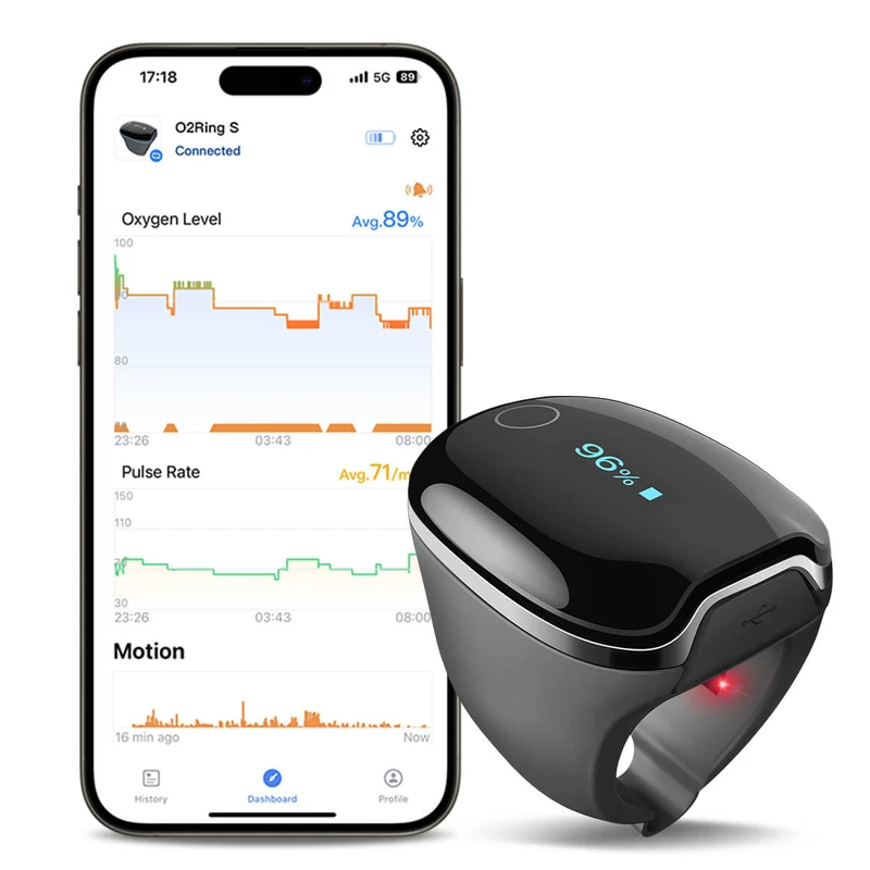 O2Ring-S Smart Ring Pulsoximeter