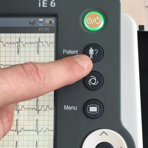 Biocare iE6 EKG-Gerät