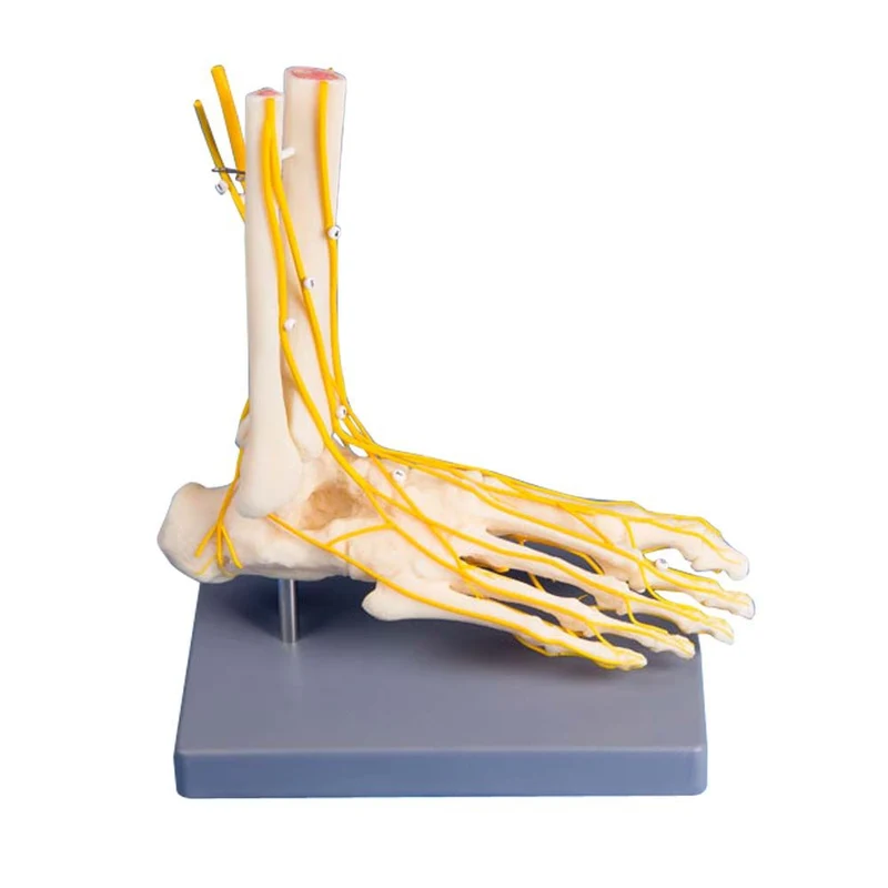 Erler Zimmer Modell - Neuro-Fuß, lebensgroß