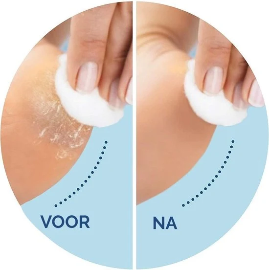Scholl Velvet Smooth Verwisselbare Roller Regular - 2 stuks- Eeltverwijderaar2st