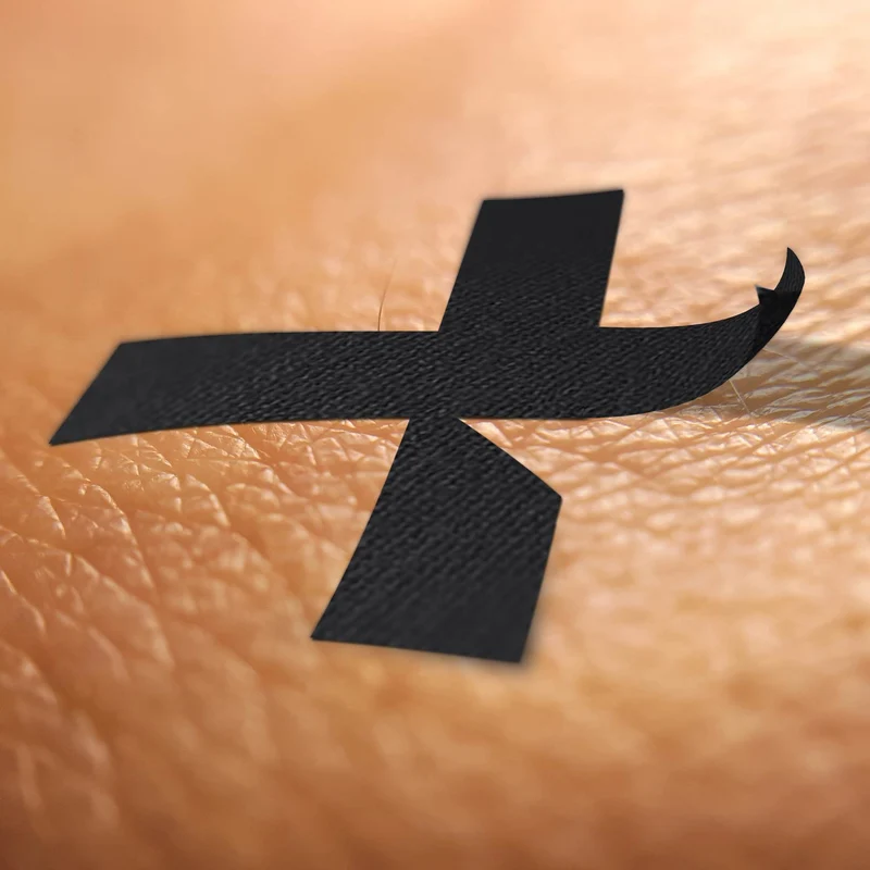 TMX® X-TAPE