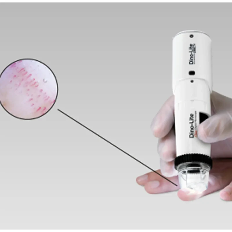 CapillaryScope 500 Pro (kabellos)