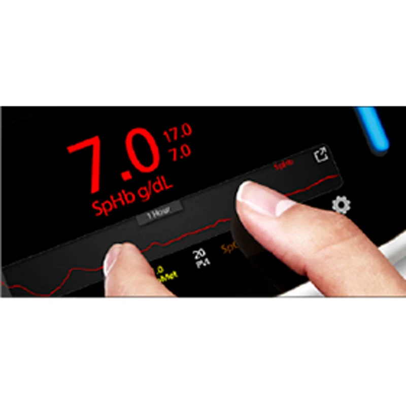 Radical-7® Pulse CO-Oximeter®