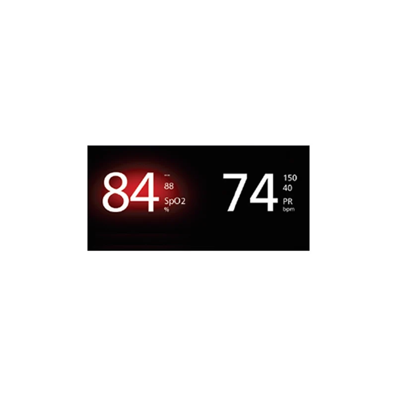 Radical-7® Pulse CO-Oximeter®