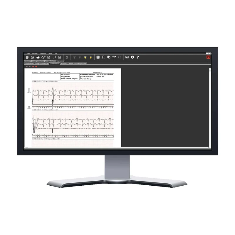 Langzeit-EKG Kobold II Auswertepaket