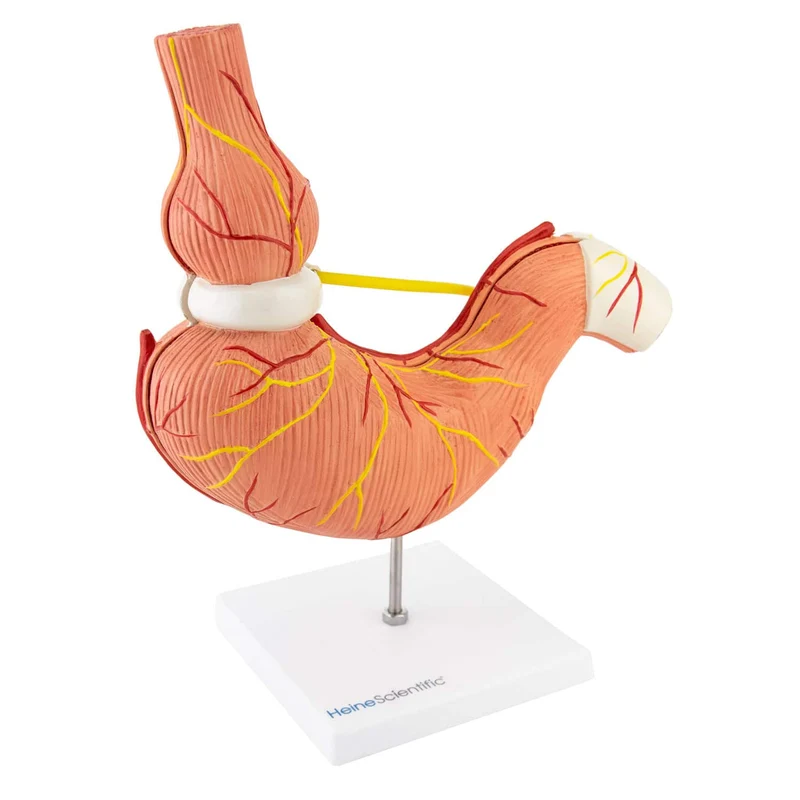 Modell Magen mit Magenband