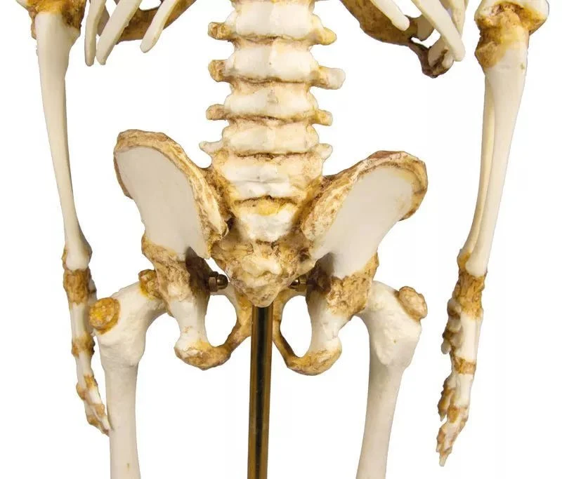 Anatomisches Kinderskelett (14–16 Monate) – Pädiatrisches Entwicklungsmodell auf Stativ