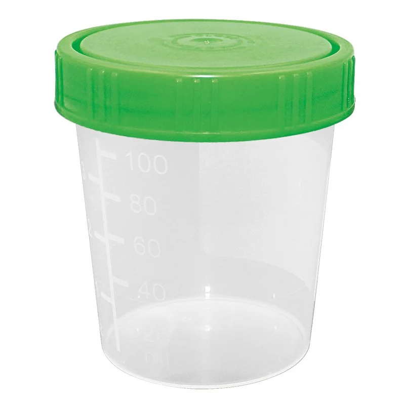 Urinbecher 100/125 ml mit Schraubdeckel