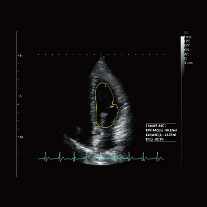 CBit 10 Ultraschallsystem