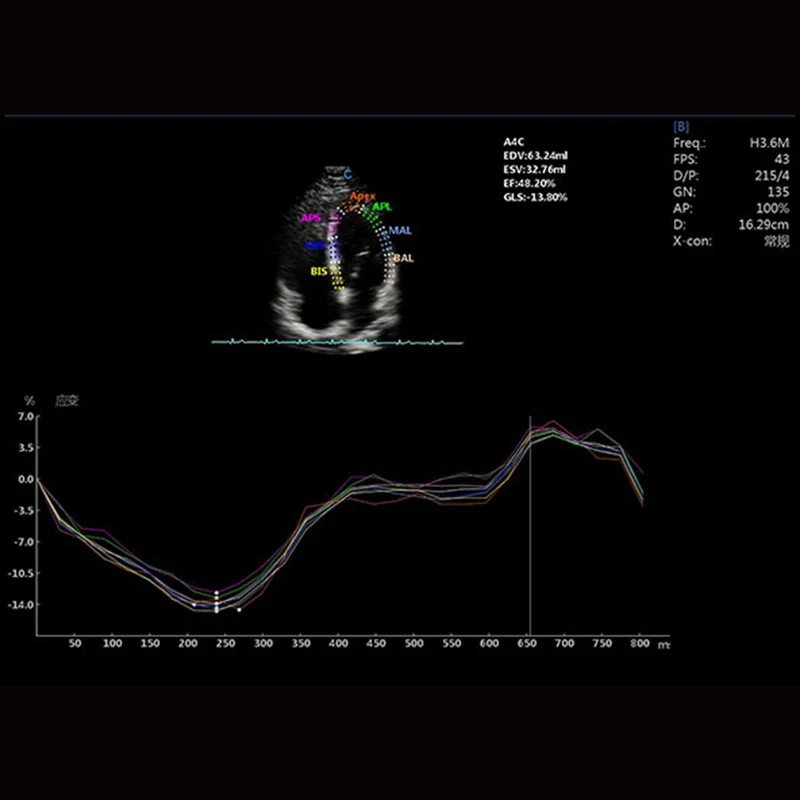 CBit 10 Ultraschallsystem