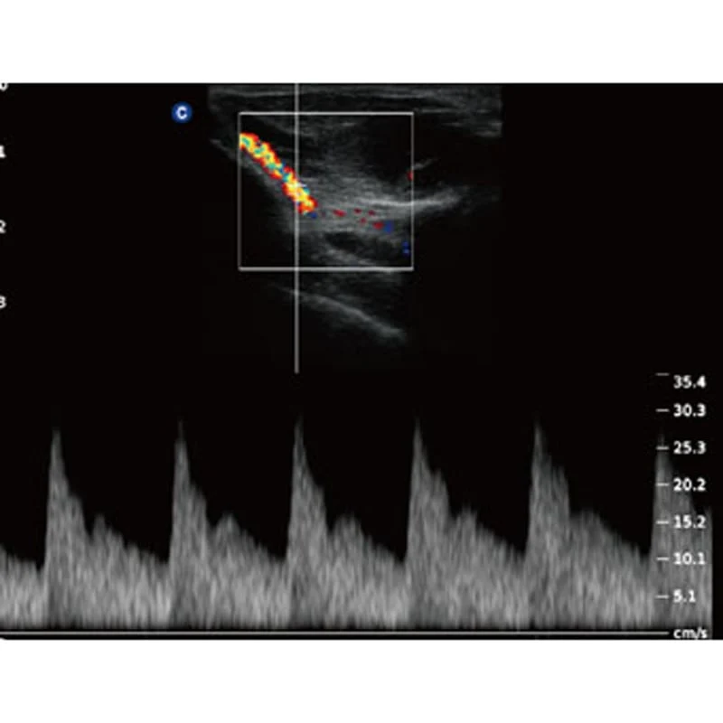 QBit5 Ultraschallgerät
