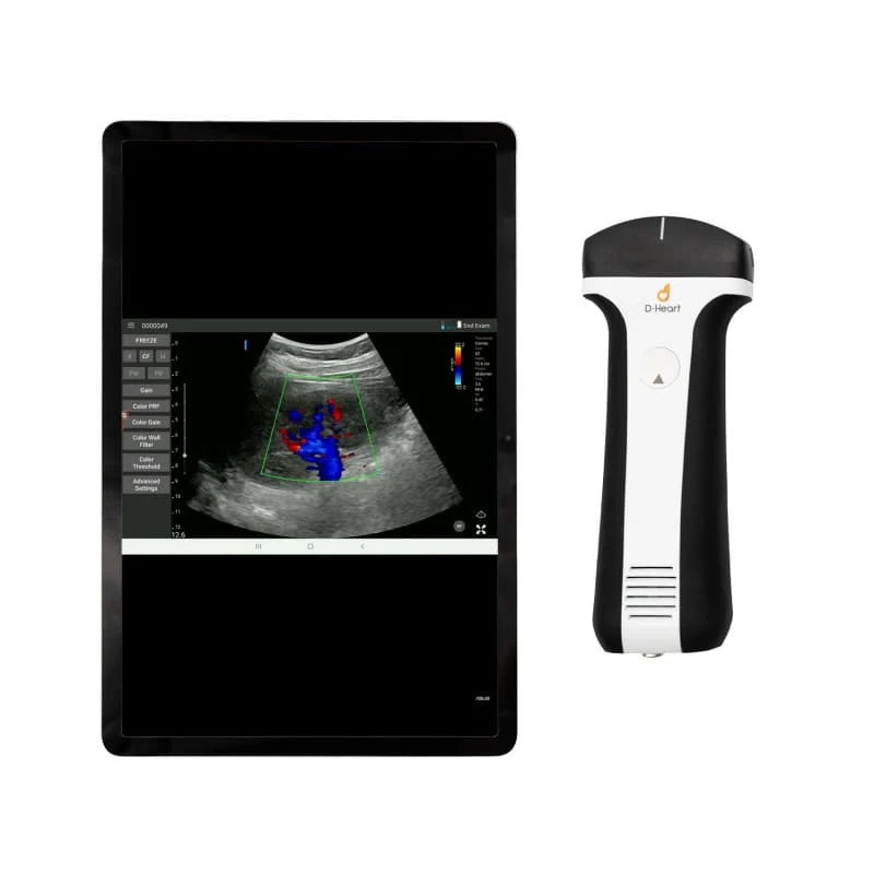 D-Heart handheld Ultraschallgerät