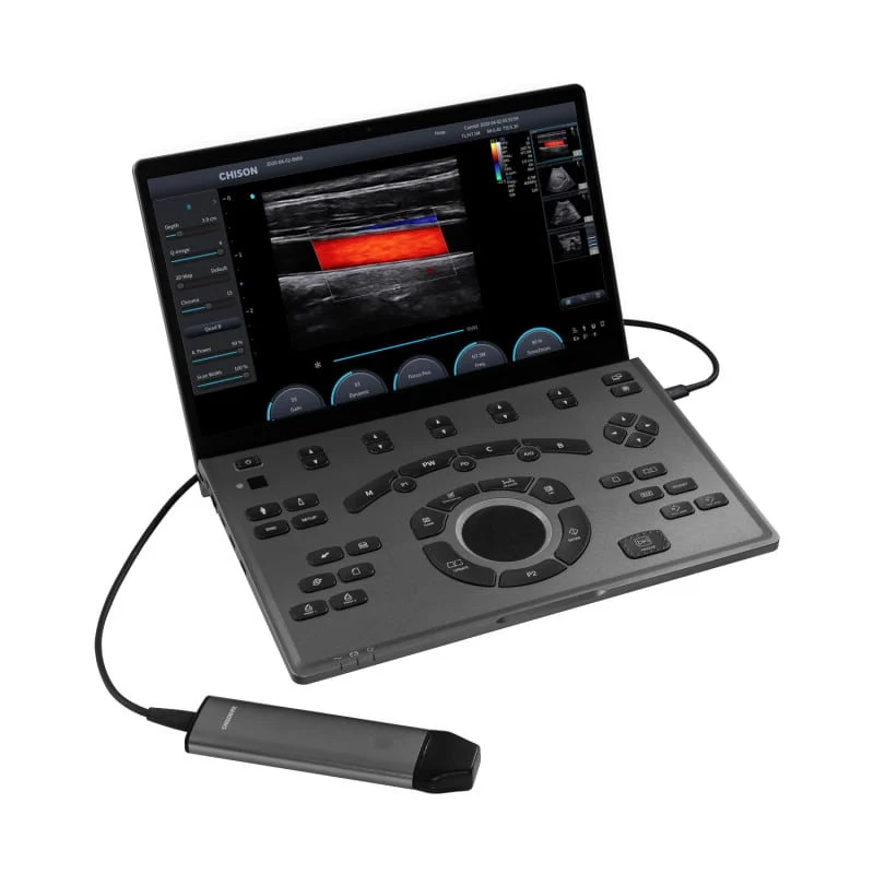 CHISON SonoAir 30