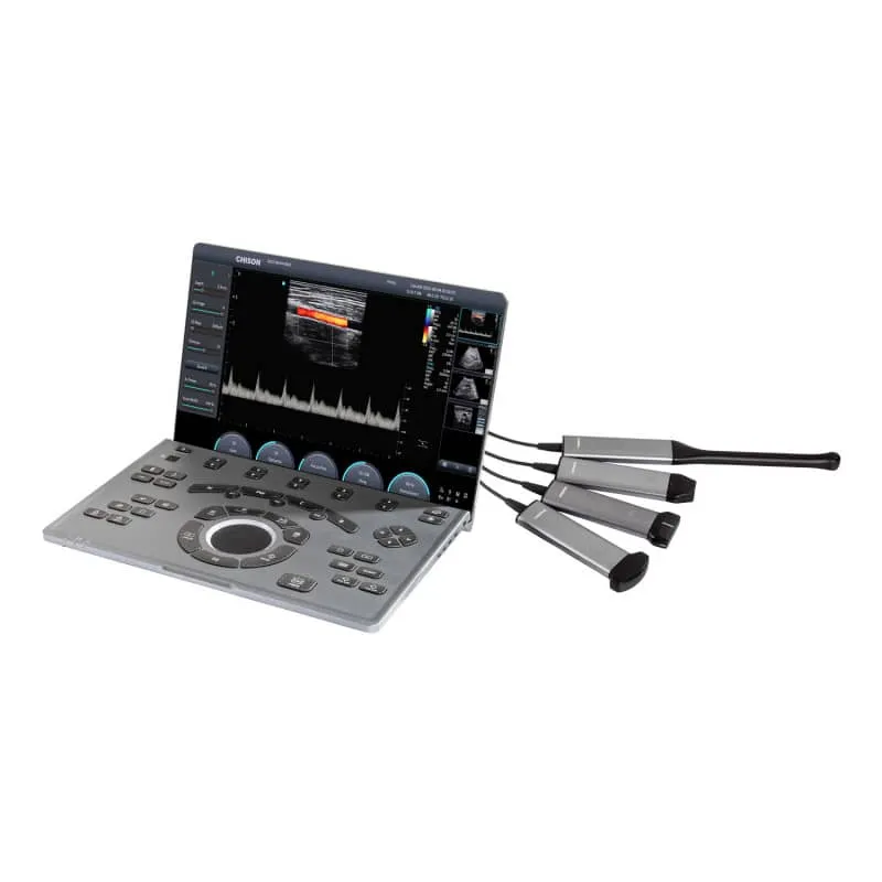 CHISON SonoAir 30