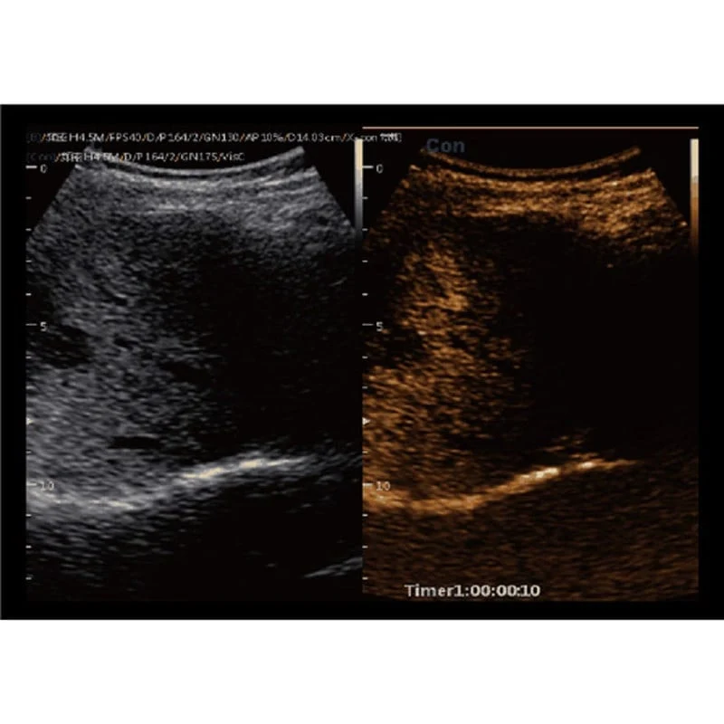 CBit9 Farbdoppler-Ultraschallsystem
