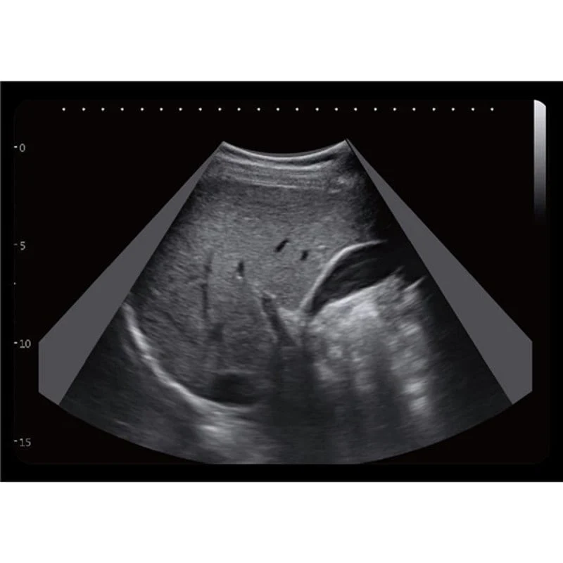 CBit6 Ultraschallgerät