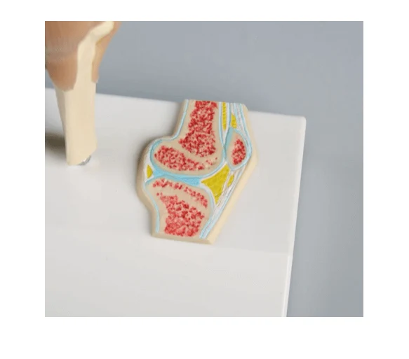 Mini-Kniegelenkmodell mit Querschnitt