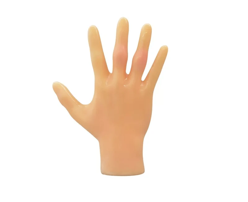 Rheumatisches Fingerphantom