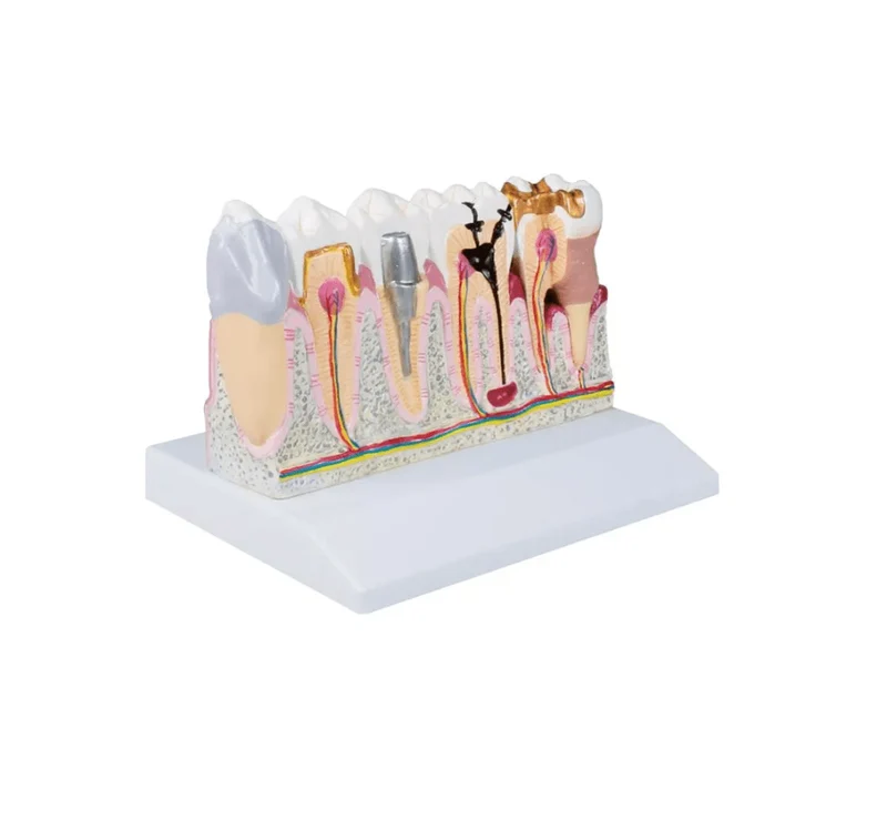 Dentalmodell, 4-fache Größe