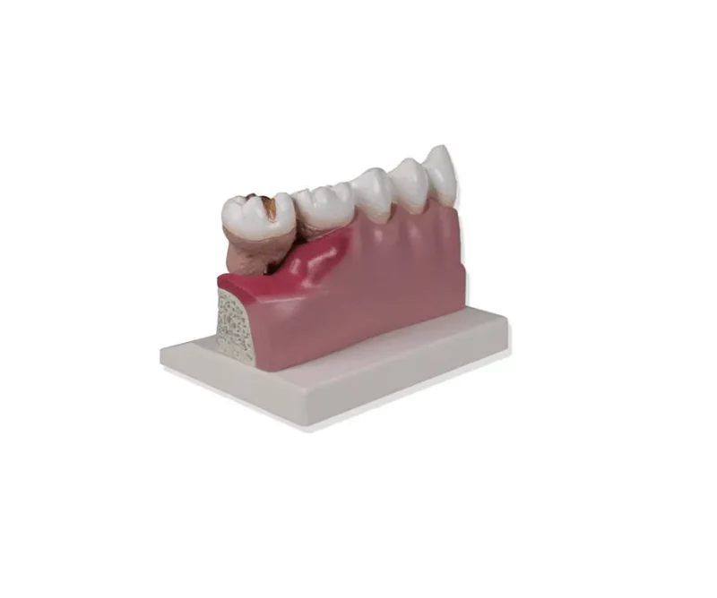 Dentalmodell, 4-fache Größe