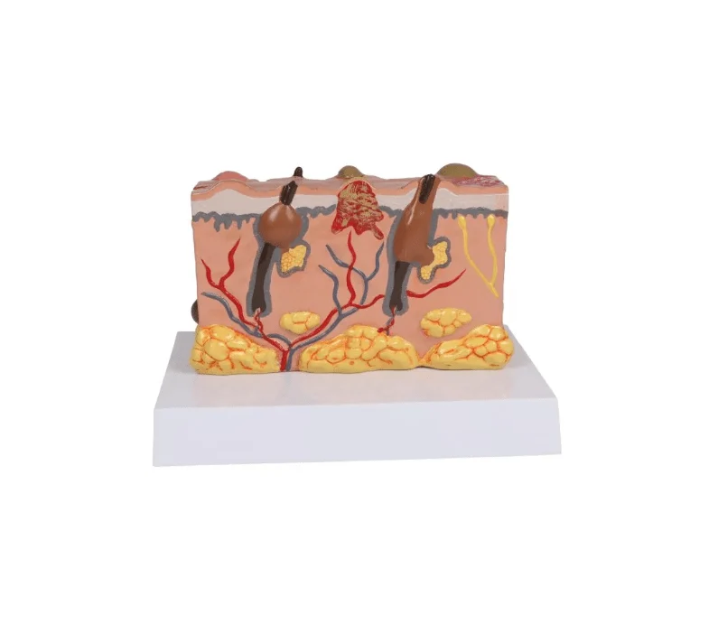 Pathologisches Hautmodel