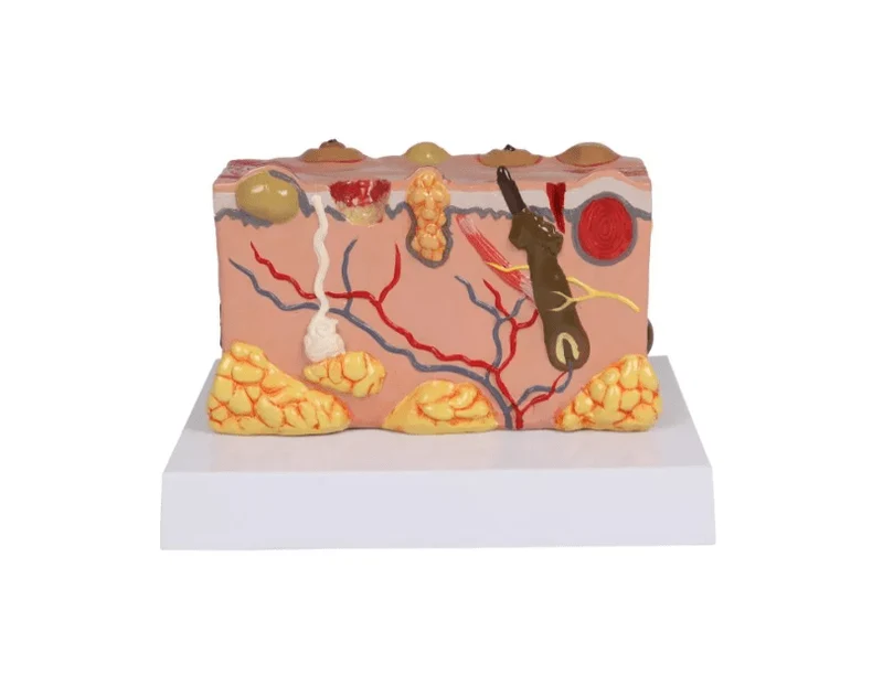 Pathologisches Hautmodel