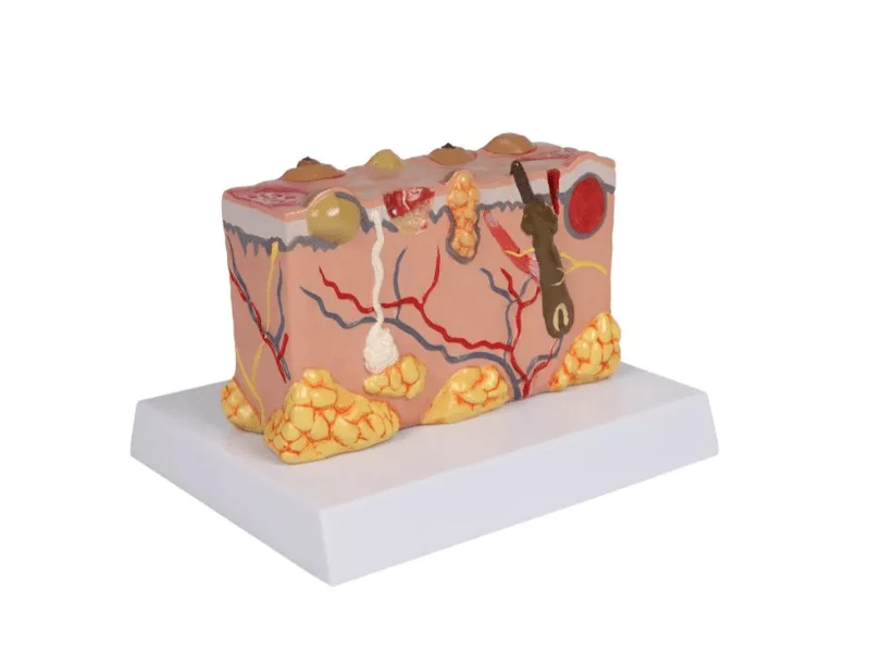 Pathologisches Hautmodel