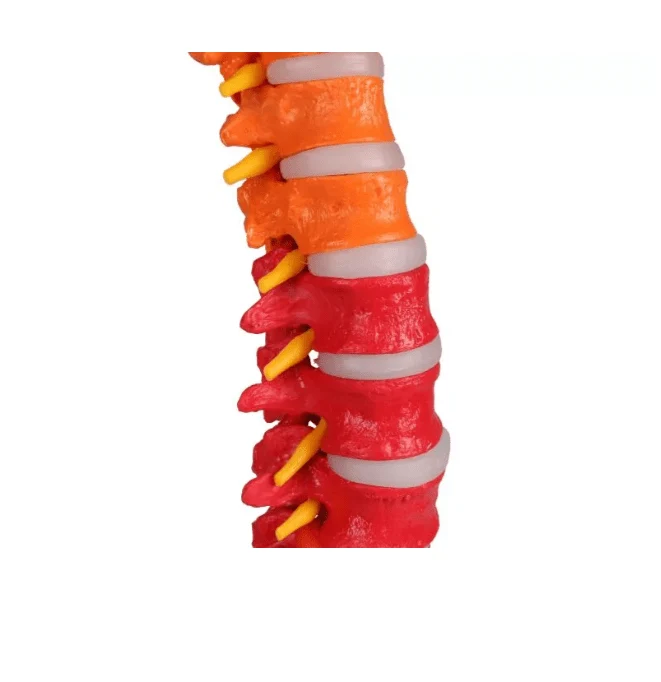 Flexible Wirbelsäule, didaktisch