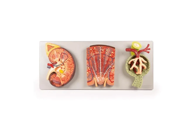 Nierenschnitt, Nephron und Nierenkörperchen
