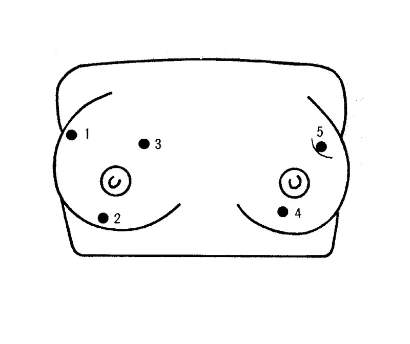Brustkrebs-Tastmodell