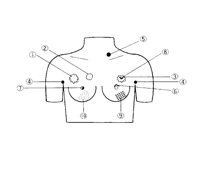 Brustkrebs-Tastmodell