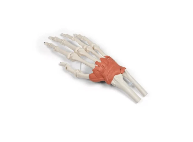 Bandapparat des Handgelenks