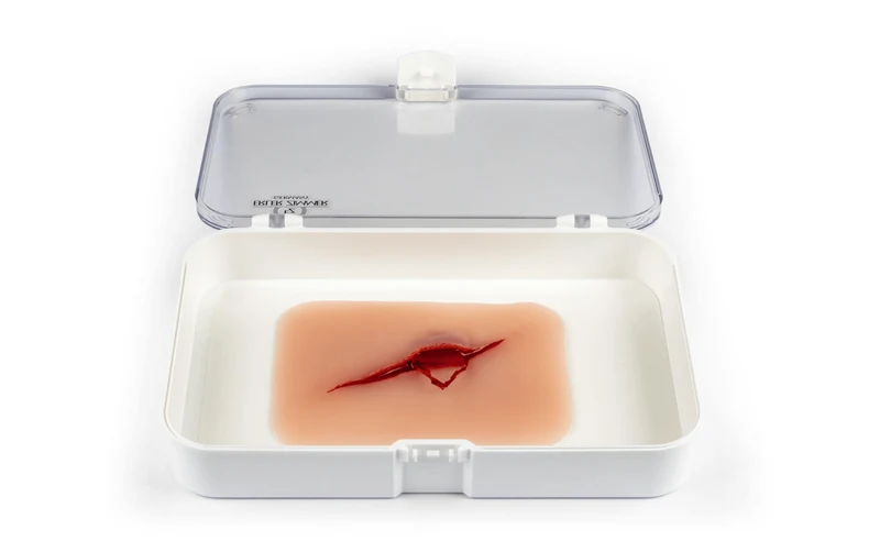 Wundmoulage Schnittwunde mit Glassplitter