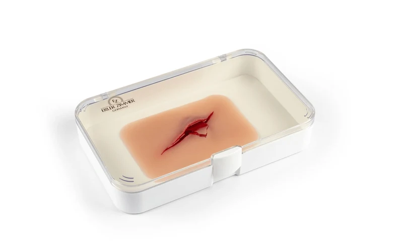 Wundmoulage Schnittwunde mit Glassplitter