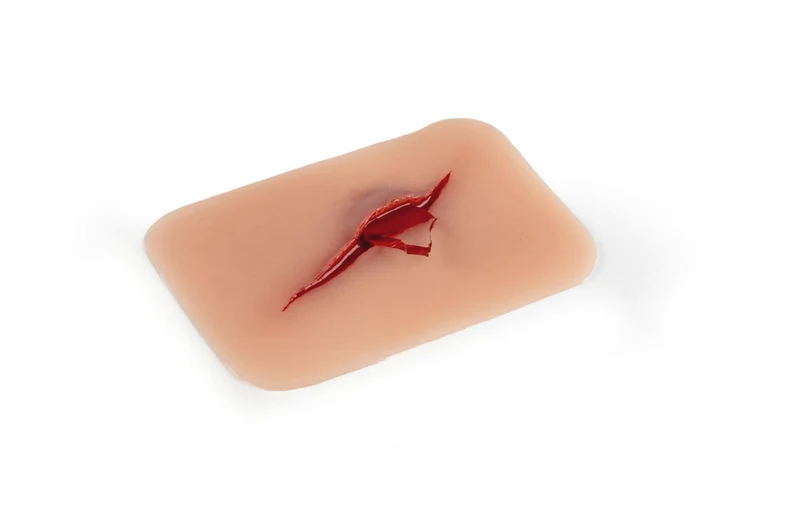 Wundmoulage Schnittwunde mit Glassplitter
