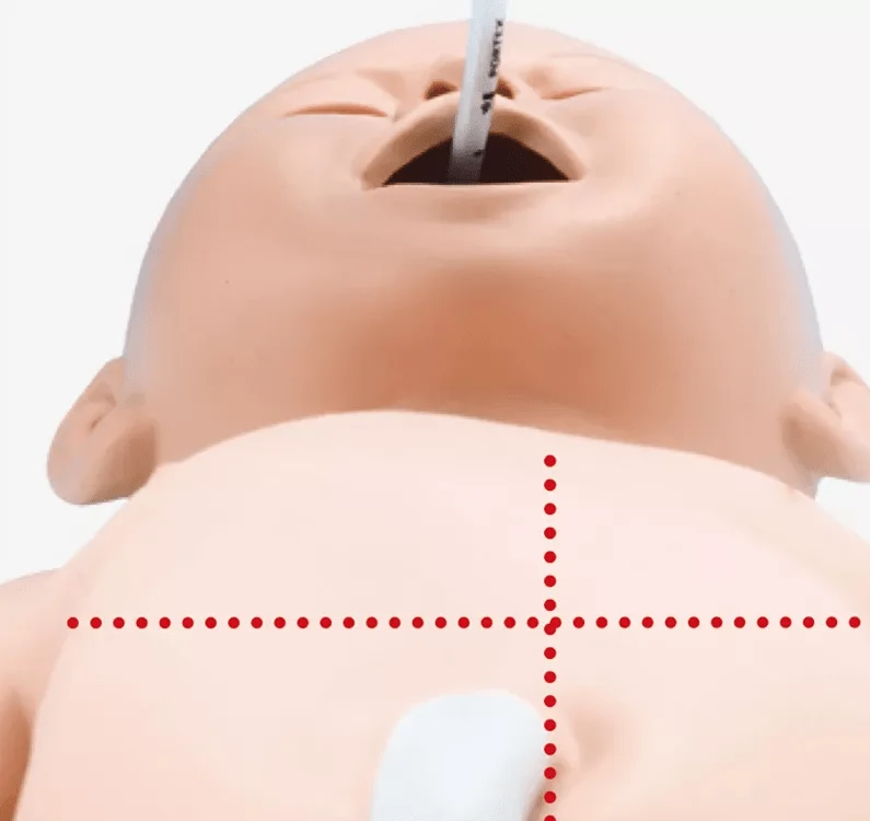 Intubations- und Wiederbelebungs-Neugeborenes