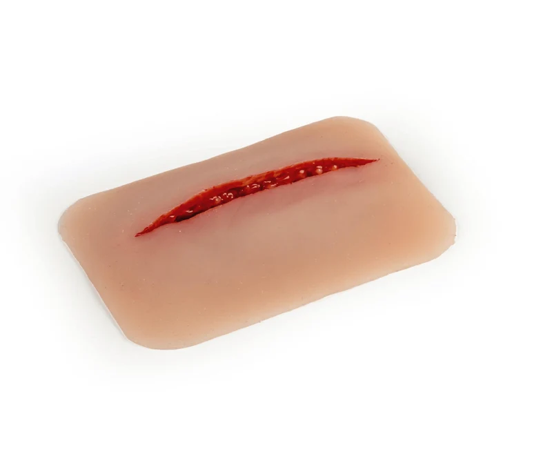 Wundmoulage Schnittwunde