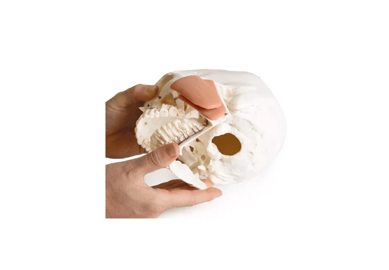 Schädelmodell für Zahnmedizin mit CMD-Syndrom, 8-teilig
