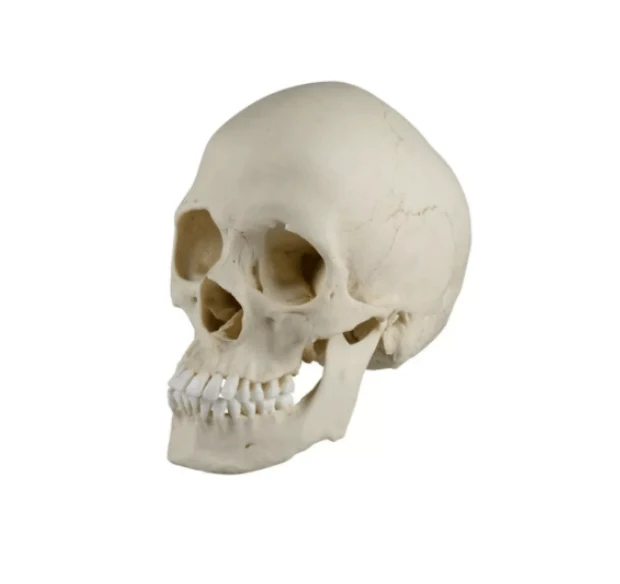 Skaphozephaler Schädel