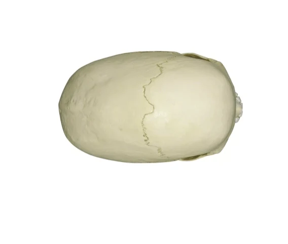 Skaphozephaler Schädel