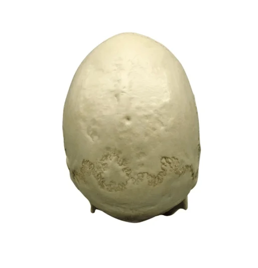 Skaphozephaler Schädel