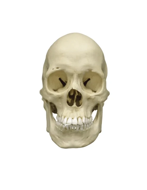 Skaphozephaler Schädel